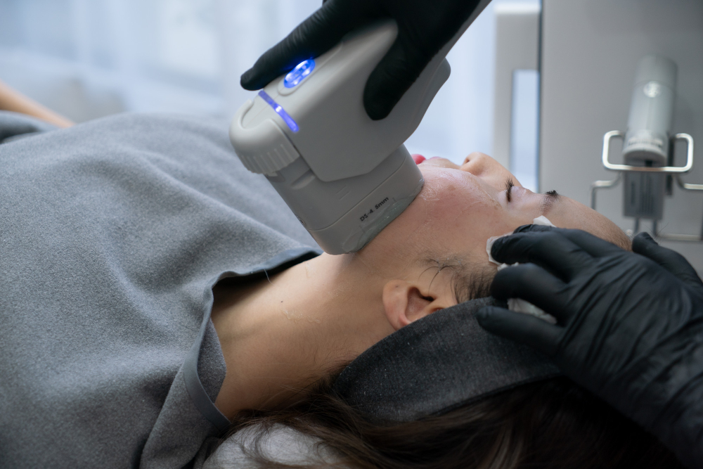 Como funciona o HIFU: porque esta tecnologia continua a conquistar clínicas de estética