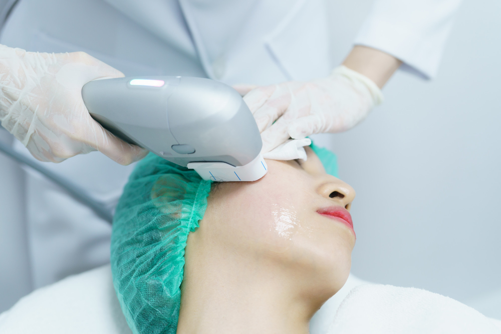 HIFU o que é: porque esta tecnologia se tornou uma referência na medicina estética